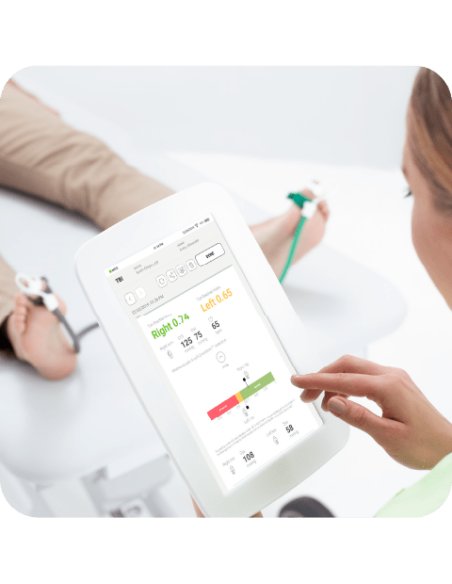 SISTEMA DE MEDICIÓN DE ÍNDICE DEDO BRAZO MESI X UNIDAD