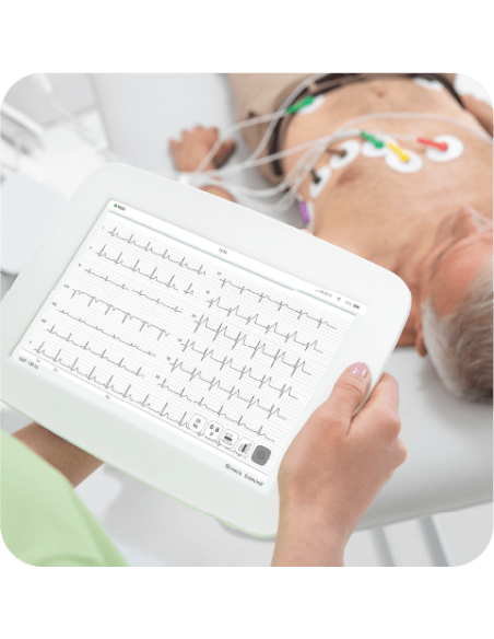 ELECTROCARDIOGRAMA MESI X UNIDAD