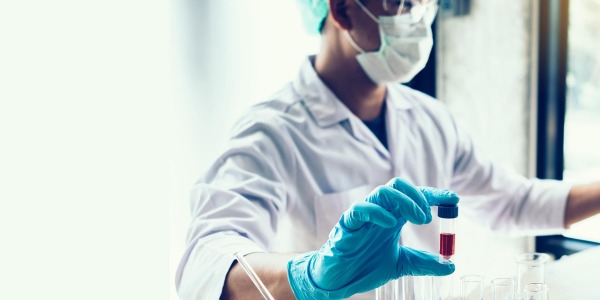 ¿Qué es el Factor VIII y cómo se relaciona con la Hemofilia A?